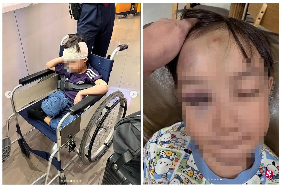 狮城男童韩国机场被撞 眼眶骨折脑震荡 家属急寻目击者 — 封面