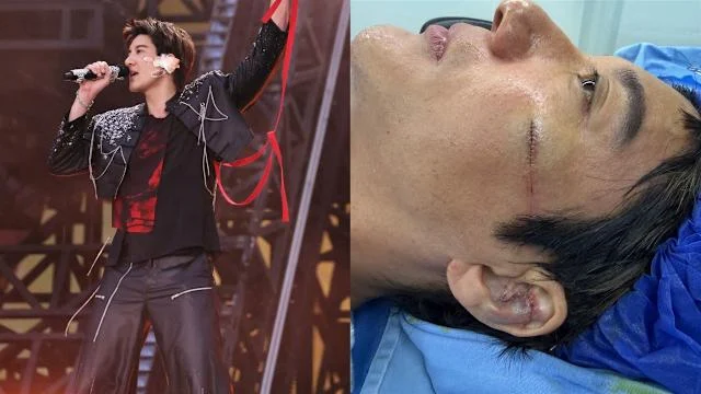 王力宏演唱会重摔! 「撞碎左耳大爆血」急诊惨缝39针伤势曝光 — 封面